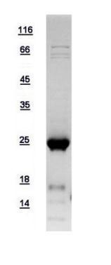 Human SAR1B protein, His tag