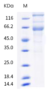 SARS-CoV-2 (COVID-19) Spike (ECD) protein, B.1.617.2 / delta variant, His tag