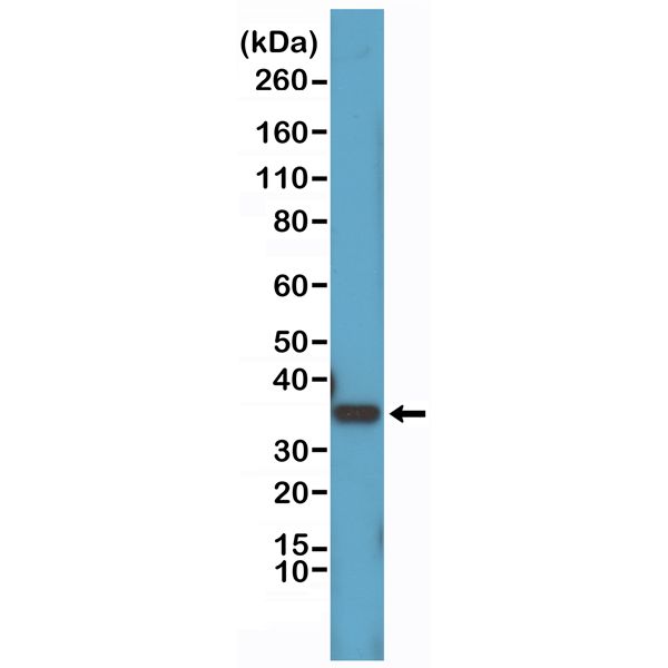 Cyclin D1 antibody [RM241]