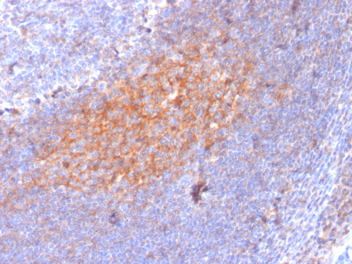 CD81 antibody [1.3.3.22]