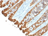 Cytokeratin 8 + 18 antibody [KRT8.18/2297R]