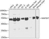 MEK7 antibody