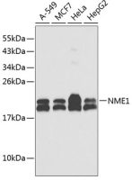 nm23-H1 antibody