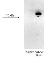 KCNN3 antibody, C-term