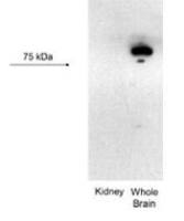 KCNN3 antibody, C-term