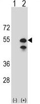 CPN1 antibody, N-term