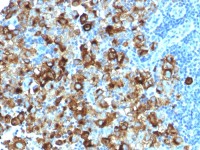 Melanoma gp100 antibody [PMEL/1825R]