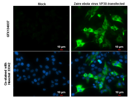 Ebola virus VP30 antibody