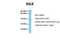 RAX antibody, N-term