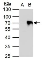 PIASy antibody