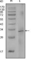 Factor VIII antibody [5E9B2]
