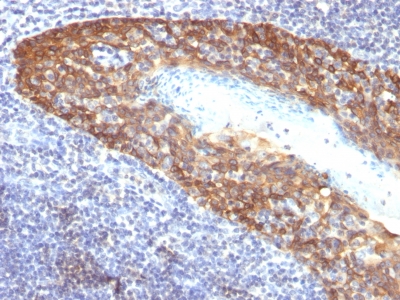 Cytokeratin 14 antibody [KRT14/532]