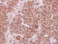 FBL4 antibody [N1C1]