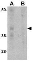 PD1 antibody [7A11B1]