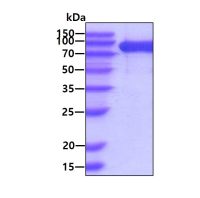 Human FAP protein, His tag (active)