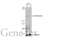 HYPB/SETD2 antibody