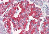 VMAT2 antibody, C-term