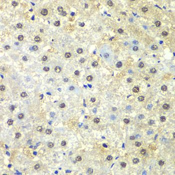 PSMD13 antibody
