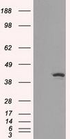 IDH1 antibody [2H9]