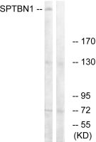 SPTBN1 antibody