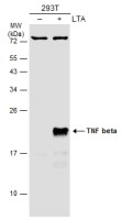 TNF beta antibody