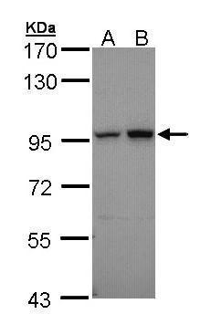 Aconitase 2 antibody [C1C3]