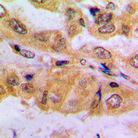 SMAD2 (phospho Ser467) antibody