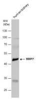 BMP7 antibody