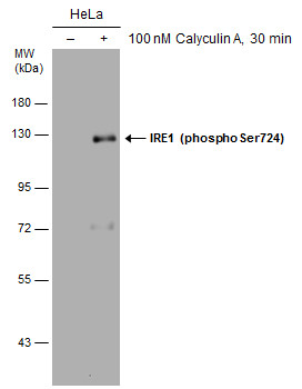 IRE1 alpha (phospho Ser724) antibody