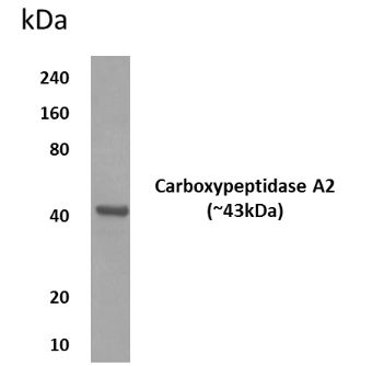 CPA2 antibody [11M21]
