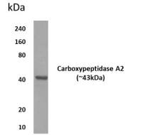 CPA2 antibody [11M21]