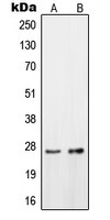 OTUB2 antibody
