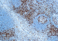 CD45RO antibody [UCHL1]