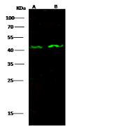 CXCR5 antibody