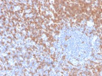 ZAP70 antibody [ZAP70/4040R]