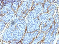 p75 NGF Receptor / CD271 antibody [SPM299]