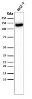E-Cadherin antibody [CDH1/2208R]