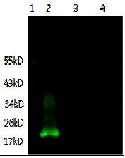 IL6 antibody [1B1-B10-D2]