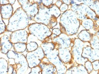Insulin Receptor alpha antibody [INSR/2277R]