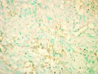 RICTOR antibody [C3], C-term