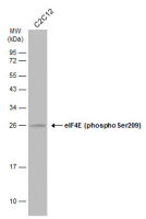 eIF4E (phospho Ser209) antibody