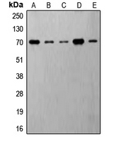 p70 S6K (phospho Thr421) antibody