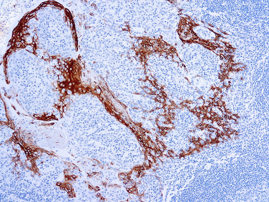 Cytokeratin 16 antibody [LL025]