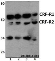 CRHR1 + CRHR2 antibody