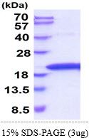 Rat TNF alpha protein, His tag (active)