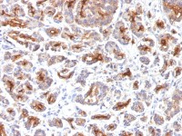 CFTR antibody [SPM176]