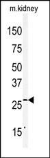 Claudin 2 antibody, C-term