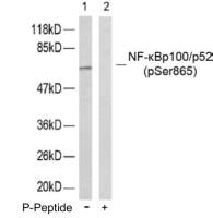 NFkB p100 (phospho Ser865) antibody