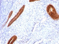 Cytokeratin 7 antibody [KRT7/760]