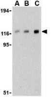 CBL antibody